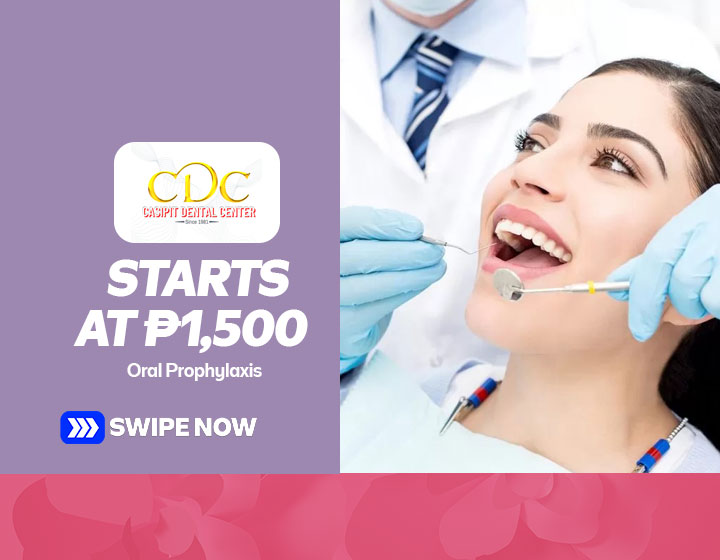 Oral Prophylaxis starts at P1,500