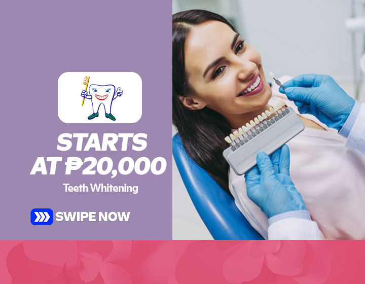 Teeth Whitening starts at P20,000