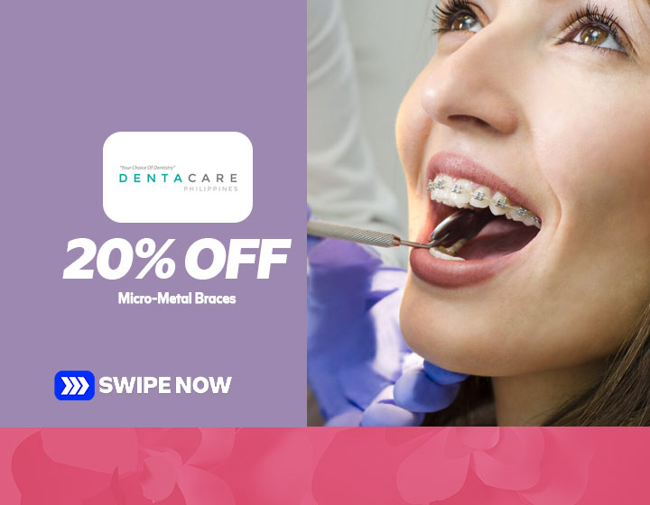 Enjoy 20% Off and a P9,999 Downpayment on Micro-Metal Braces