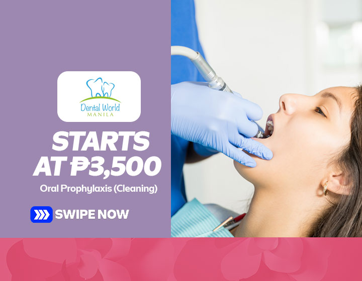 Oral Prophylaxis (Cleaning) starts at P3,500