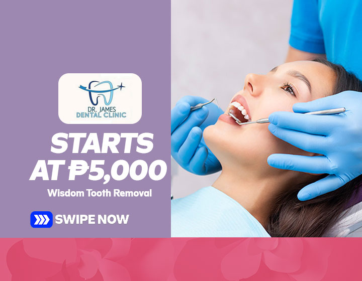 Wisdom Tooth Removal starts at P5,000