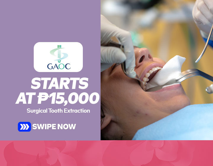 Surgical Tooth Extraction starts at P15,000