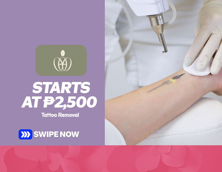 Tattoo Removal starts at P2,500