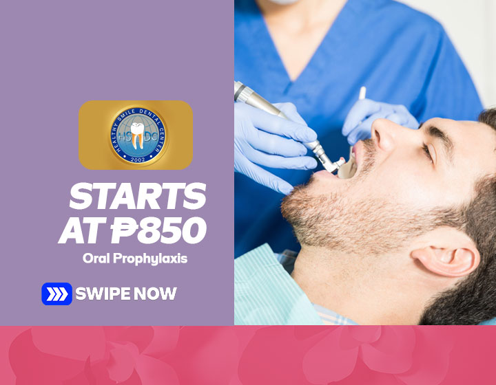 Oral Prophylaxis starts at P850 