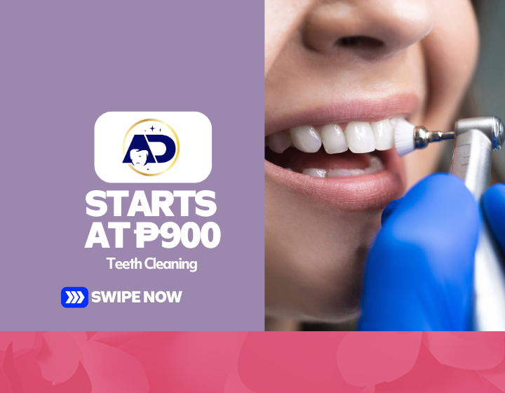Teeth Cleaning Starting At P900