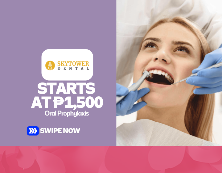 Oral Prophylaxis Starting At P1,500