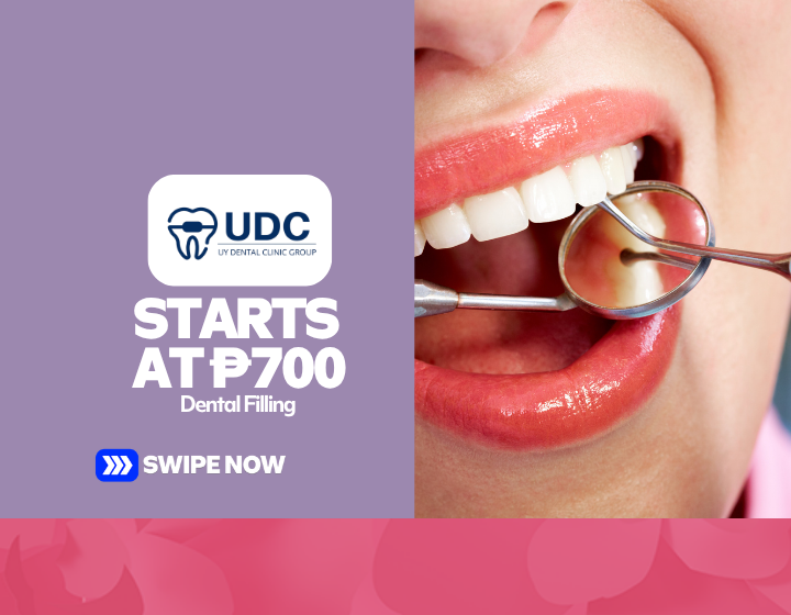 Dental Filling Starting At P700