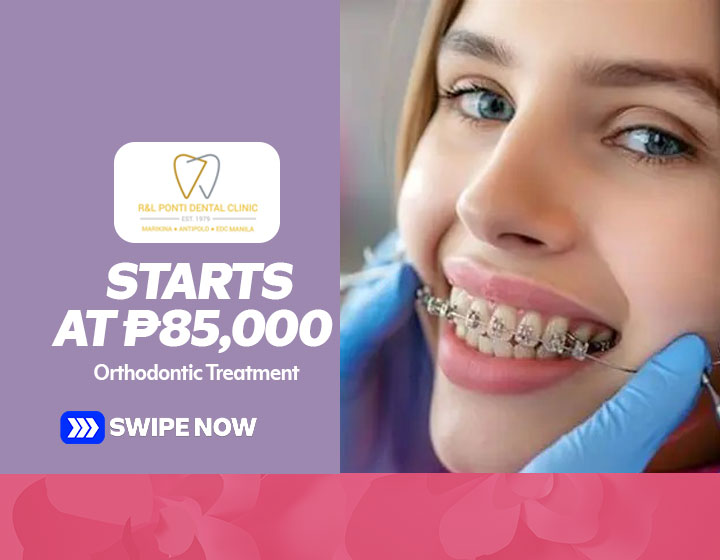 Orthodontic Treatment starts at P85,000