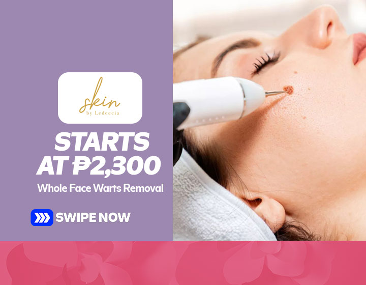 Warts Removal - Whole Face starts at P2,300