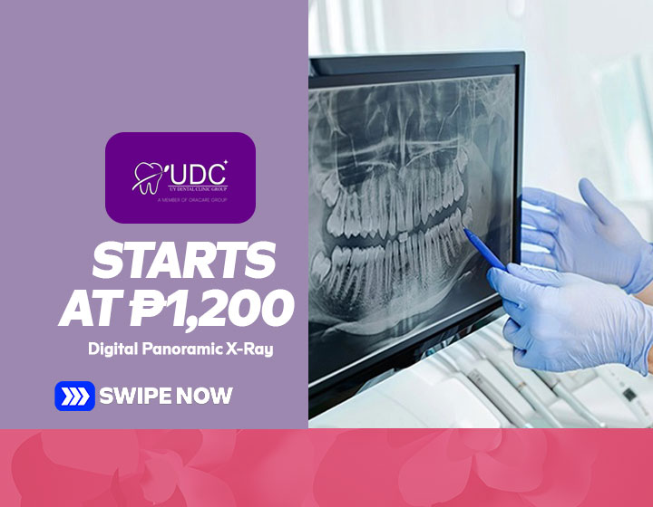 Digital Panoramic X-ray starts at P1,200