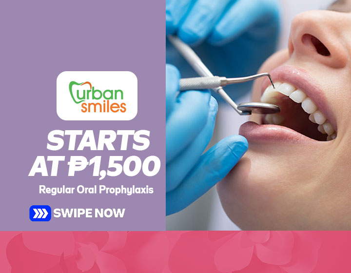 Regular Oral Prophylaxis starts at P1,500